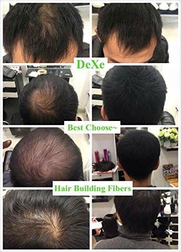 Easy to Use Lose Hair Building Fibres Black Colour 22g